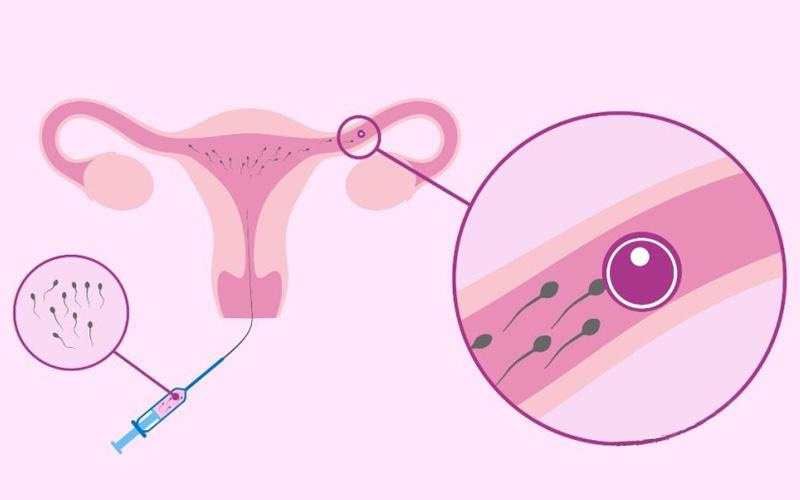 常德借卵自怀试管-用捐赠卵子做试管婴儿的缺点介绍! 一起来看看高龄女性借卵受精的风险。