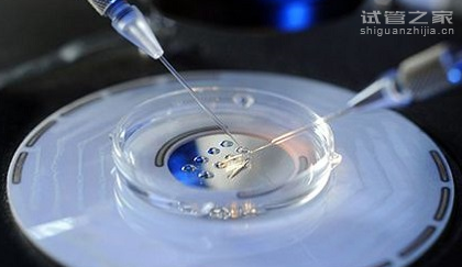 滁州53岁助孕公司：降低抑制植入的分子水平可提高IVF的成功率
